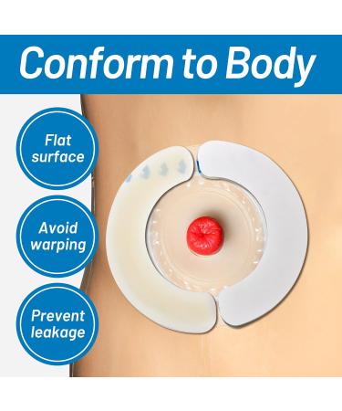 Heagimed 10PCS Elastic Barrier Strips - Hydrocolloid Skin Barrier for Ostomy Bags - Buy Online on GoSupps.com