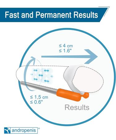 Andropenis Mini Penis Extender for Penile Enlargement. Micropenis Enlarger with medical backup and clinical studies. Reliable and Safe Therapy. - Buy Online on GoSupps.com