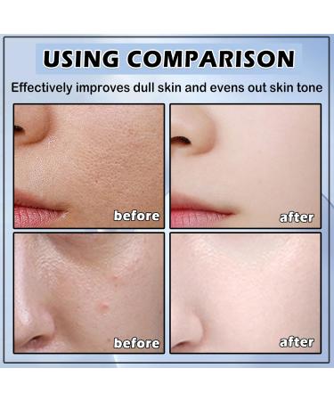 Niacinamide 10% + Zinc 1% Serum for Face - Oil Control & Pore Reducing Moisturizer for Women (30ML - Buy Online on GoSupps.com