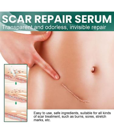 Scar Repair Essence - Acne & Dark Spot Remover for All Skin Types (3 pieces) - Buy Online on GoSupps.com