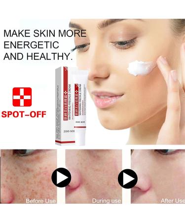 Spot Off Freckle Whitening & Dark Spot Corrector Cream - Acne Scar & Melasma Removal Treatment for Face (2 Pcs) - Buy Online on GoSupps.com