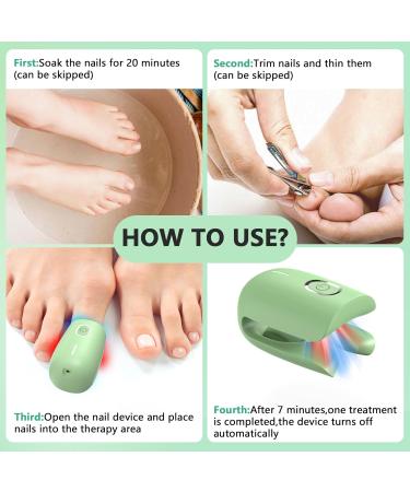 Nail Fungus Laser Treatment Device - Home Use onychomycosis Remover with 470nm Blue Light 660nm Red Light & 905nm Infrared Light - Buy Online on GoSupps.com