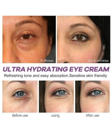 Vitamin C Eye Cream | Hydrating Anti-Aging Moisturizer for Dark Circles & Puffiness | Retinol Eye Wrinkle Treatment - Buy Online on GoSupps.com