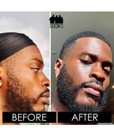 Dixon's 1737 Beard Butter - Natural Moisturizing Balm for Beard Care Patches Filling & Dry Beard Solution - Paraben & Sulfate-Free (2oz - Buy Online on GoSupps.com