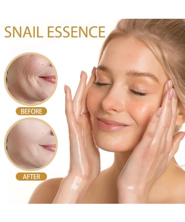 Generic Snail Repair Essence - 100ml Hydrating Face Serum with 98% Snail Mucin for Brightening & Dark Spot Reduction (3PCs) - Buy Online on GoSupps.com
