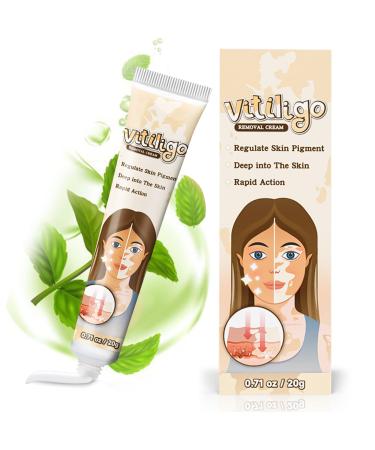 Vitiligo Treatment Cream Natural Vitiligo Treatment for Skin Vitiligo Improve Skin Pigmentation & Reduces White Spots Suitable for All Skin yellow/Vitiligo
