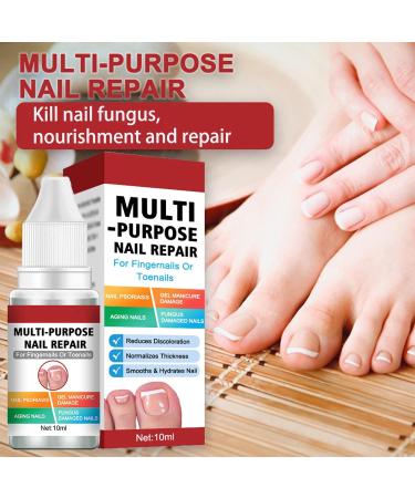 Fungal Nail Treatment Solution - Extra Strong Repair for Toenails & Fingernails - Safe & Effective - 2pcs x 1.00 ml - Buy Online on GoSupps.com