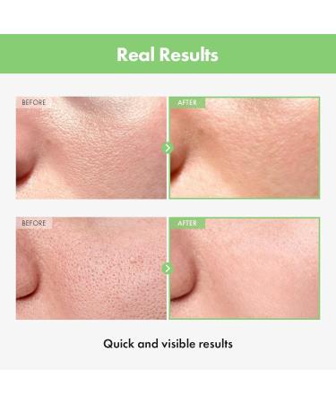 Green Tomato Pore Ampoule - 20 000ppm Green Tomato Witch Hazel & Hyaluronic Acid for Moisturizing & Pore Minimizing | Korean Skincare 30ml - Buy Online on GoSupps.com
