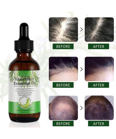  Tioueo Rosemary Oil for Hair Growth 60ml Rosemary Essential Oil for Hair Growth Hair Loss Scalp Enhancement Eyebrow & Eyelash Growth for Men & Women - Buy Online on GoSupps.com