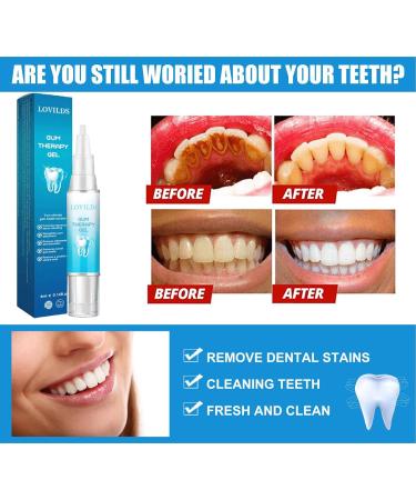 Lovilds Gum Therapy Gel - Effective Gum Care Solution | Lovilds Gel Reviews & Neslemy Gum Shield (3PC) - International Shipping Available - Buy Online on GoSupps.com