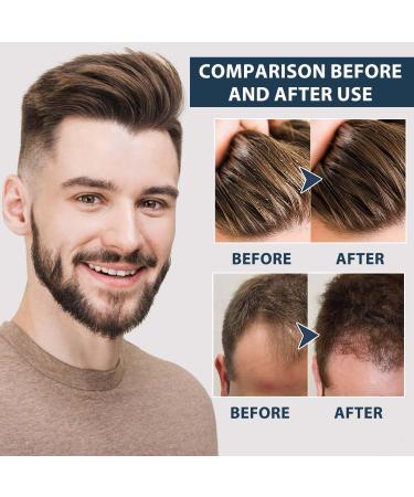 Anti Hair Loss Shampoo for Men - Volumizing & Suitable for All Hair Types (100ML) | International Shipping Available - Buy Online on GoSupps.com