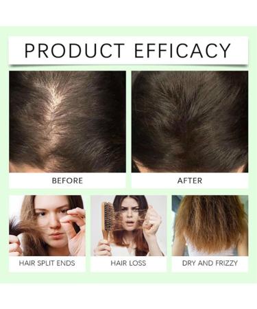 Shantou Youjia AntiHair Fall Hair Loss Shampoo - Buy Online on GoSupps.com