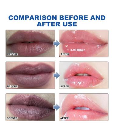 Moisturizing Lip Balm Repair Stick | Aloe Vera & Honey Formula for Dry Chapped Lips | 24HR Hydration with Vitamin B12 & Peony Extract (3.8g - Buy Online on GoSupps.com