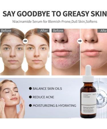 Retinol 0.5% in Squalane Serum Anti-Aging Serum Retinol Serum for Face Hyaluronic Acid Serum for Activate Skin Face Serum for Women Anti-Wrinkle Serum Smooth Skin Hyaluronic Acid Moisturiser - Buy Online on GoSupps.com