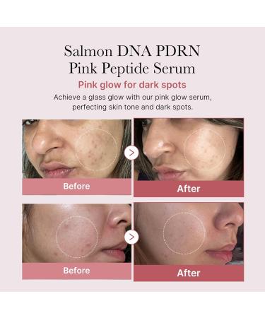 medicube Overnight Renewal Salmon PDRN Duo: Salmon DNA PDRN Pink Peptide Serum and Salmon DNA PDRN Pink Collagen Capsule Cream - Buy Online on GoSupps.com