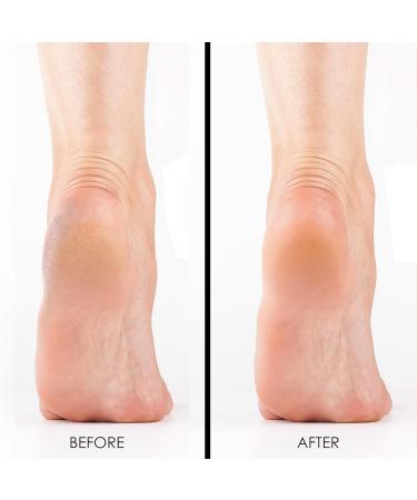 DeEnti Pumice Stones - 6 Pack Professional Grade Foot Callus Remover | Salon Quality Double Sided Pedicure & Manicure Tools - Buy Online on GoSupps.com