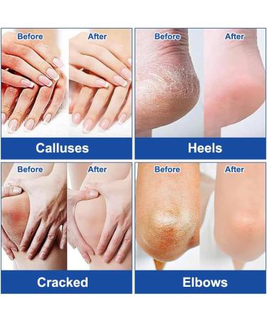 2 Pi ces Creme Anti Crevasse Pied 60% Creme Pied Uree Stick creme pied Sec Cr me Hydratante Pour Les Pieds et Talons - Buy Online on GoSupps.com