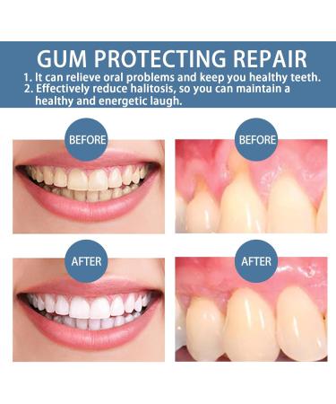 Qylen Gum Repair Gel Qylen Teeth Repair Gel Mullend Gum Repair Gel Teeth Whitening Essence to Reduce Yellowing Oral Care for Sensitive Teeth and Gums (3ps) - Buy Online on GoSupps.com