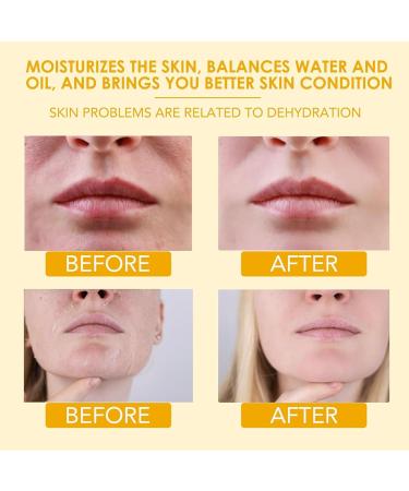 2 Packs Beef Tallow for Skin Tallow and Honey Balm for Face Organic Grass-Fed Beef Tallow Balm with Raw Wild Honey Body & Face Moisturizer Natural Formula (Citrus) 2 Pack-Citrus - Buy Online on GoSupps.com