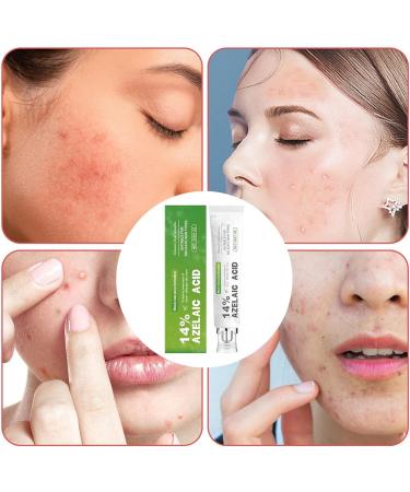  JINGLING JINGLING Women's Face Moisturizer Skin Tone Even Gel 30g - Gentle Moisturizer with Pore Minimizer for Face Suitable for Men and Teenagers for Travel Home and Daily Use - Buy Online on GoSupps.com