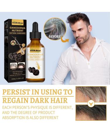 FASSME Hair Growth Scalp Oil Deep Nourishing Anti Gray Hair Care Liquid30ml Natural Hair Growth Oil Stop Thinning and Hair Loss Suitable for All Hair Types - Buy Online on GoSupps.com