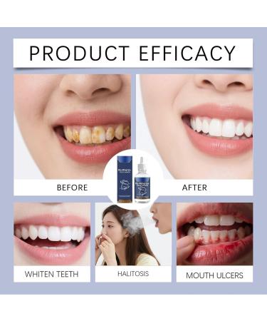 Caries Care Liquid | 60 ml Refreshing Health Drops Dental Enamel Drops - for Caries Cleaning Health Repair Hygiene Enamel Protection - Buy Online on GoSupps.com