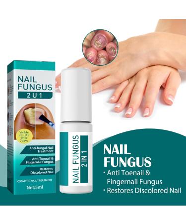 Nail Fungus Serum For Toenail-Natural Anti Fungal Treatment Extra Strong Repair Essence Fungal Nail Polish For Finger & Toe Nails - Buy Online on GoSupps.com