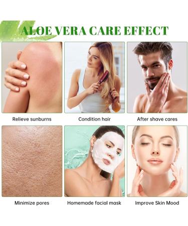 Gel d'Aloe Vera Gel d'Aloe Vera Bio 300 ml Cr me Hydratante Naturelle pour R parer les Coups de Soleil Peau S che Peau Sensible - pour le Visage les Cheveux et le Corps - Buy Online on GoSupps.com