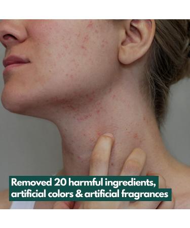 Porsica Ampoule Vegan Facial Serum | Calming Hydrating Repairing | Centella Asiatica 76% | Blemish & Acne-prone Skin Care | Sebum & Pore Minimizing | No-scent | Fine Lines Improvement - Buy Online on GoSupps.com
