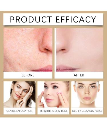 Shantou Hoygi Biological Rice Moisturizing White Rice Exfoliant 100 ml Rice Ampoule White Rice Scrub Dead Skin Cells Remover for Face and Body White Rice Scrub Solution Pores Minimizer - Buy Online on GoSupps.com