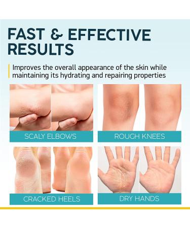 Urea Cream 40% for Feet - Maximum Strength Foot Repair Lotion with Salicylic Acid, Shea Butter, Tea Tree Oil & Vitamin E - Dry Cracked Heels Treatment - 5.29 oz - Buy Online on GoSupps.com