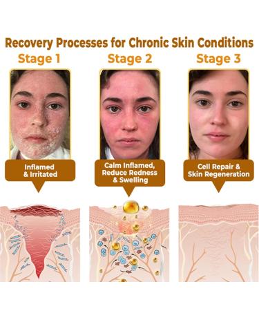 AEEHFENG Bee Venom Skin Repair Cream Advanced Bee Venom Firming Serum Stick Firming & Wrinkle-Reducing Cream Hydrating Natural Ingredients Suitable for All Skin Types (4 Bottle) - Buy Online on GoSupps.com