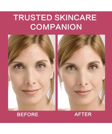 3 Pack Rose Hyaluronic Acid Serum - Moisturizing Anti-Wrinkle Face Care (1FL.OZ) | International Shipping - Buy Online on GoSupps.com