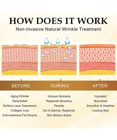 Face Wrinkle Patches - 160 Anti-Wrinkle Patches for Eyes Mouth & Forehead | Overnight Smooth Skin Solution - Buy Online on GoSupps.com