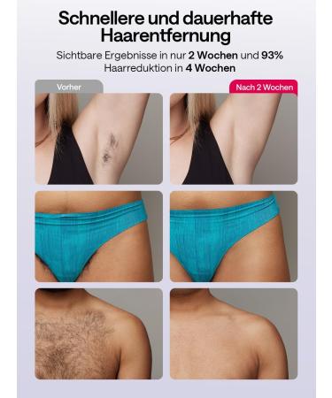 Ulike Air 10 IPL Hair Removal Device - Pain-Free Long-Lasting Results Skin Sensor 4 Attachments for Home Use Perfect for Body & Face - Purple - Buy Online on GoSupps.com
