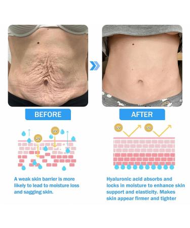 Fivfivgo Ultra Firming & Revitalizing Cream Advanced New Fivfivgo Skin Firming Cream Body Lotion Moisturizer Face Lotion & Body Cream-Renew Skin Firmness for All Skin Types (1Bottle 60ml) 1Bottle 2.02 Fl Oz (Pack of 1) - Buy Online on GoSupps.com