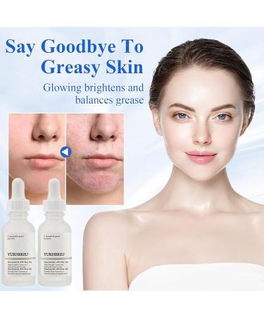 Niacinamide Serum the oirdenariy Niacinamide 10% + Zinc 1% Original Skincare Serum Niacinamide Face Moisturizer Pore Reducer Blemishes for Blemish-Prone Dull Skin Softens Balancing Sebum (30ml*2) - Buy Online on GoSupps.com