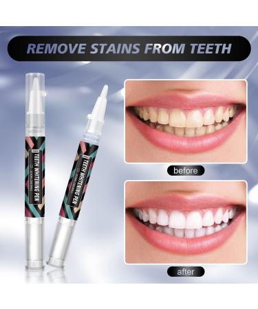 Teeth Whitening Pen Gel Kit - Painless No Sensitivity Travel-Friendly | Results in 2 Weeks - Easy Home Use - Buy Online on GoSupps.com