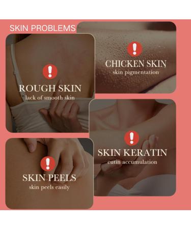 Body Scrub Exfoliator - Strawberry Body Exfoliator - Gentle Clean Face & Body Scrub - Bright Skin Exfoliating Body Scrub - Body Exfoliator Scrub Moisturize Ice Cream Texture Strawberry Flavor 220g - Buy Online on GoSupps.com