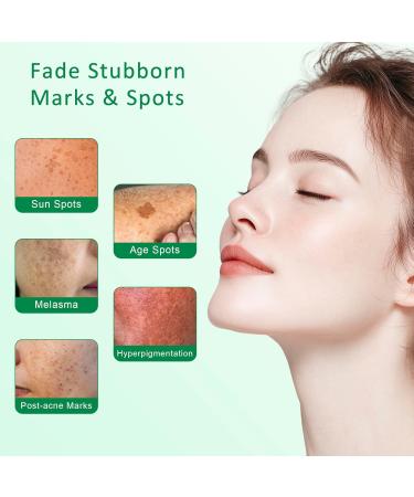 Dark Spot Remover for Face & Body Dark Spot Corrector Serum for Hyperpigmentation Brown Spots & Melasma Treatment - 1.7 fl oz 1.7 Fl Oz (Pack of 1) - Buy Online on GoSupps.com