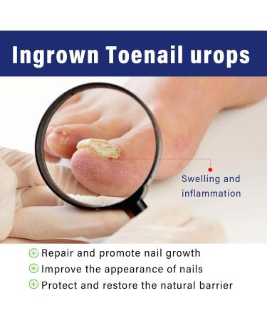 Nail Treatment Nail Repair Solution for Toenails cuticle protection & strengthening Restoring Nails 30ML - Buy Online on GoSupps.com