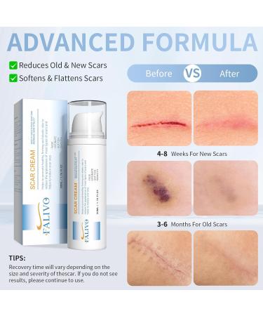 Scar Cream 50g - Effective Silicone Gel for Surgical Scars Stretch Marks Acne & More - Fast Scar Removal for Face & Body - Buy Online on GoSupps.com