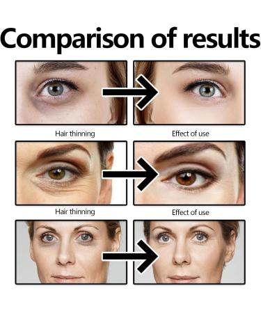 Instant Iift Plus Dark Circles Wrinkle Reducing Eye Cream Under Eye Bags And Wrinkles Instant Eye Lift. Instantly Removes Bags Firming And Fading Fine Lines Moisturizing Skin Hydrating Eye Cream (1) - Buy Online on GoSupps.com
