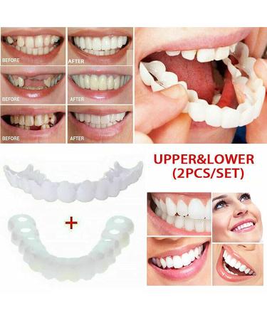 Xindinuo Snap-On Veneer Teeth - 2 Pairs | Instant Dentures for Men & Women for Confident Smile - Buy Online on GoSupps.com