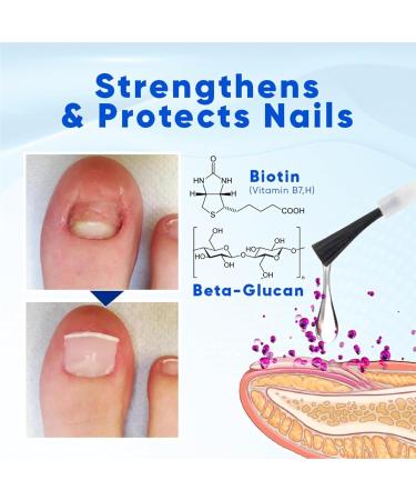  Generisch Nail strengthening liquid - 15 ml - Renewal solution to strengthen nails - Care for damaged nails and toenails for women men and grandparents - Buy Online on GoSupps.com