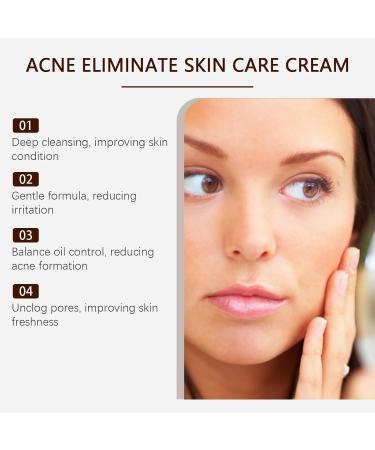 JOYVOIDX Herbal Acne Face Cream with Salicylic Acid Oil Balancing Formula for Gentle Pimple Care and Shine Control Moisturizing Skin Care 2.0 fl oz - Buy Online on GoSupps.com