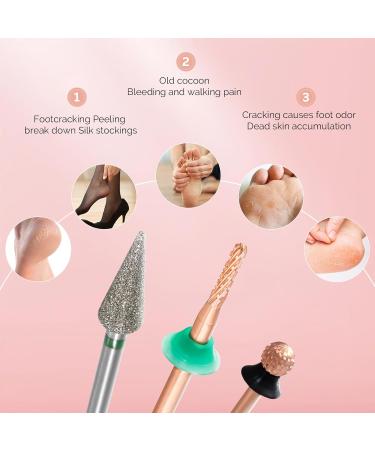 MelodySusie 5.0MM Ball Shape Pedicure Bit - Extra Coarse 3/32 Carbide Tungsten Tool for Callus Removal & Nail Preparation | Beginners Rose Gold Series Bit-S - Buy Online on GoSupps.com