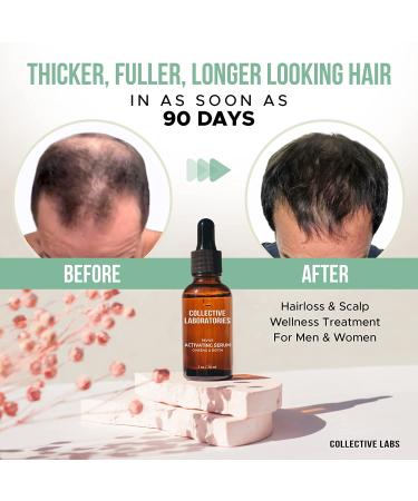 Collective Laboratories Hair Growth Treatment: Natural DHT Blocker, Scientifically Proven Results in 90 Days for Thicker, Stronger, Fuller Hair - Men & Women - Includes Shampoo, Conditioner, and Serum/Hair Oil - Buy Online on GoSupps.com