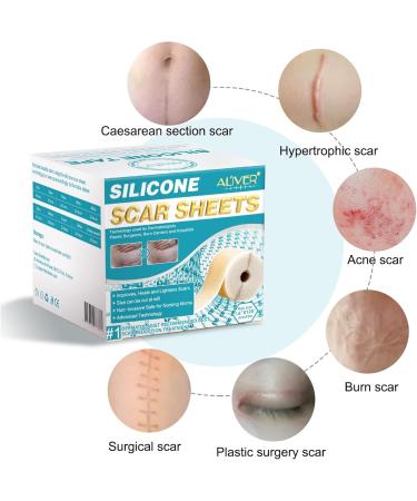 Silicone Surgical Scar Removal Patch for Trauma, Burn, Acne Treatment | Skin Repair Therapy - Buy Online on GoSupps.com