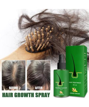 Hair Growth Serum - Anti-Hair Loss Treatment for Thinner Hair | Thickening & Re-Growing Solution (1 PC) - Buy Online on GoSupps.com